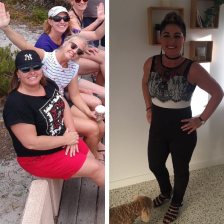 Lisa before and after bariatric surgery - Advance Surgical Perth