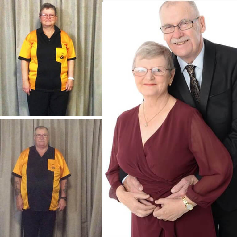 Before and after gastric sleeve Perth